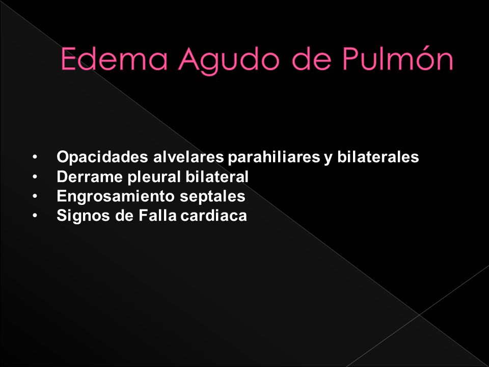 Imagenes radiologicas de edema pulmonar